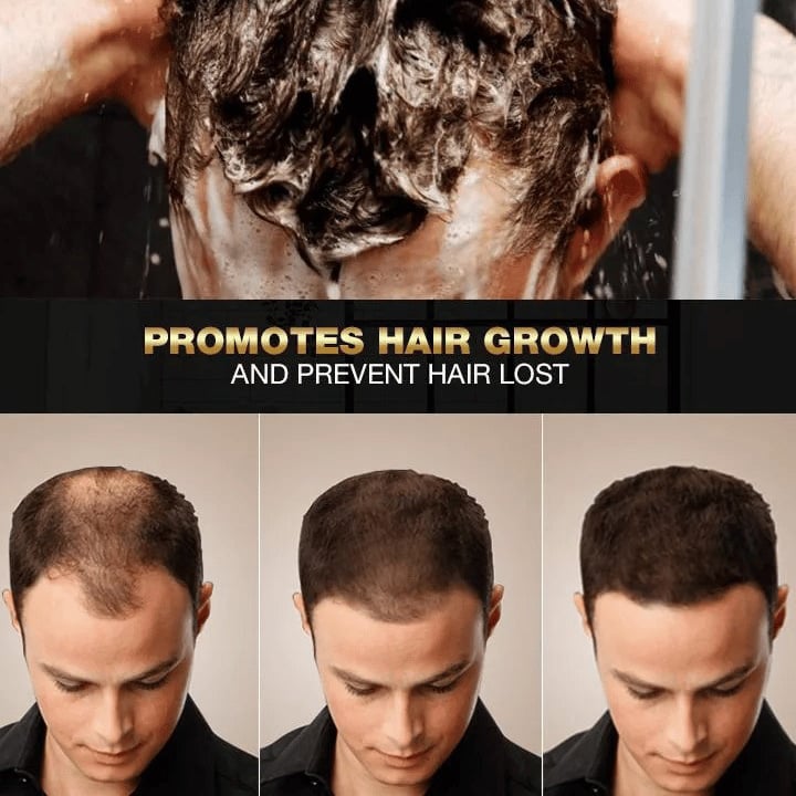 💥2023 New Hair Darkening Shampoo Soap - Hair Turns Black - Prevent Hair Loss - Nourishes Hair Growth